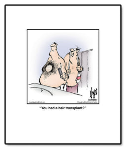 You had a hair transplant?